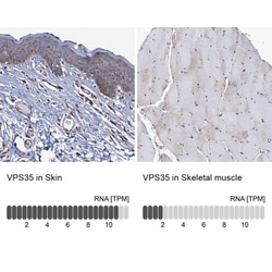 VPS35 Antibody, Novus Biologicals 0.1mL; Unlabeled:Antibodies, Polyclonal
